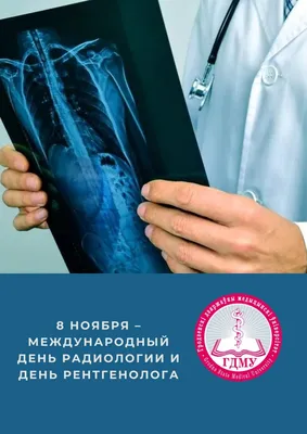 8 листопада - День рентгенолога в Україні та Міжнародний день радіології ::  ЕЛЕКТРОННА ОХОРОНА ЗДОРОВ`Я