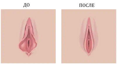 Картинки половых губ