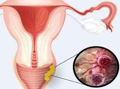 Лабиопластика: что это? – Mammaclinic