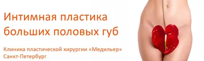 Лабиопластика или уменьшение малых половых губ - это вид интимной пластики,  операция по удалению увеличенных фрагментов малых половых губ.✍️ Главное  показание к проведению лабиопластики – психологический и физический  дискомфорт, который мешает ...