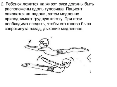 Детский церебральный паралич (ДЦП): факторы развития, причины и симптомы,  особенности лечения