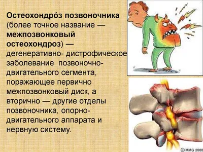 MedWeb - Хронический гастрит: лечебная гимнастика