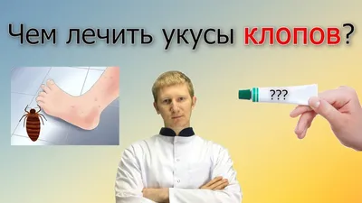 Укус Клопов как Лечить - Марафет