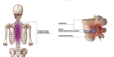 Можно ли при остеохондрозе делать массаж | Блог Royal Thai SPA