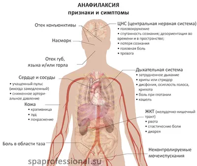 Клинические рекомендации (протокол лечения) «Анафилактический шок в  акушерстве» - Факультет Медицинского Права