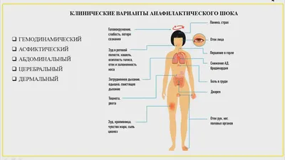 Анафилактический шок. Как действовать? | MedAdvisor