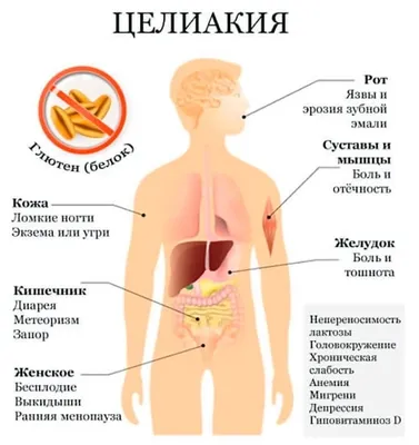 Неделя профилактики заболеваний желудочно-кишечного тракта