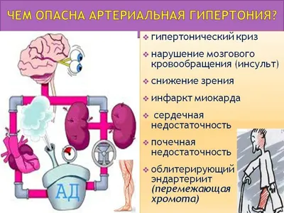 Городская клиническая больница №7 | Артериальная гипертензия