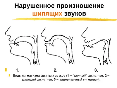 Автоматизация звука [Ш]. «День рождения Маши»