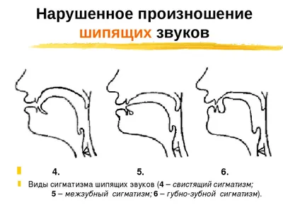 Постановка шипящих звуков: способы и приемы постановки шипящих звуков у  детей. Блог Лого-Эксперт