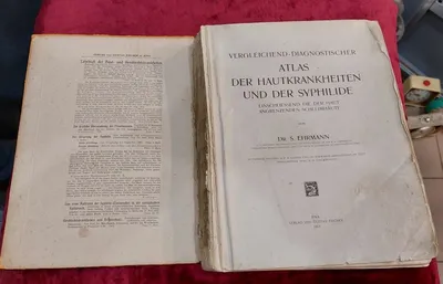 Атлас кожных заболеваний 1912 года: 2 500 грн. - Книги / журналы Харьков на  Olx