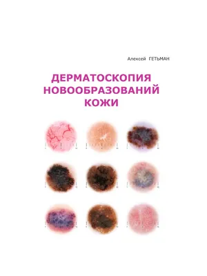 атлас - справочник РАНЫ диагностика и лечение Роуз Л. Хэмм - купить по  лучшей цене в интернет-магазине Подолог - интернет магазин для мастеров  педикюра.