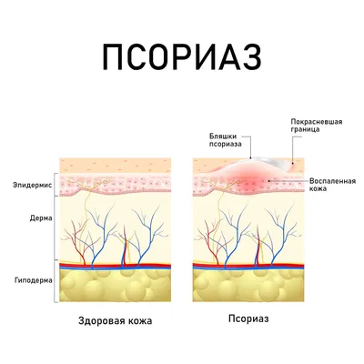 С 4 по 10 сентября – Неделя профилактики кожных заболеваний