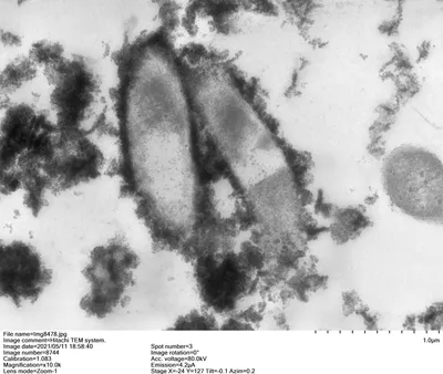 Бактерии Bordetella Коклюша, 3D Иллюстрации. Грамотрицательные Коккобацилл  Бактерии, Которые Вызывают Инфекции Детей Коклюш Фотография, картинки,  изображения и сток-фотография без роялти. Image 73932329