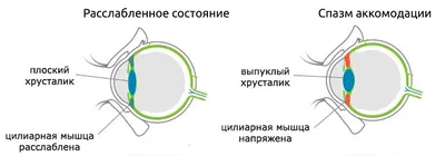 Близорукость у ребенка | Медицинский центр Здоровый ребенок