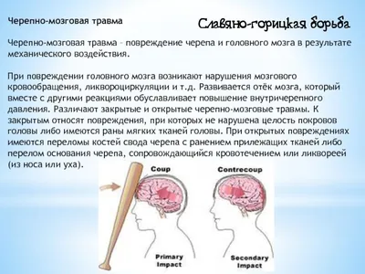 Черепно-мозговая травма: биомеханика, патогенез и первичная диагностика ч.2  | Славяно-горицкая борьба | Дзен