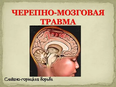 Черепно-мозговая травма: биомеханика, патогенез и первичная диагностика ч.1  | Славяно-горицкая борьба | Дзен