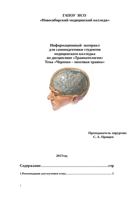 Черепно-мозговая травма