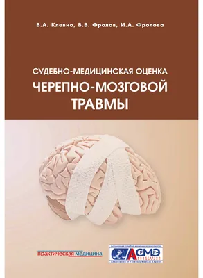 Черепно-мозговая травма. Механогенез, морфология и судебно-медицинская  оценка - купить с доставкой по выгодным ценам в интернет-магазине OZON  (175569298)