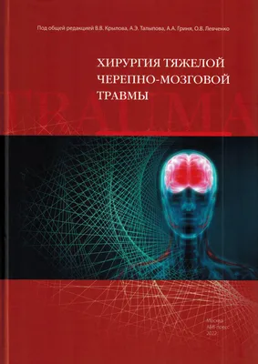 Черепно-мозговая травма и отек мозга: парень умер после двух недель в  ярославском СИЗО