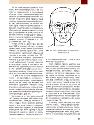 Черепно-мозговая травма - Судебная медицина от Forens.ru