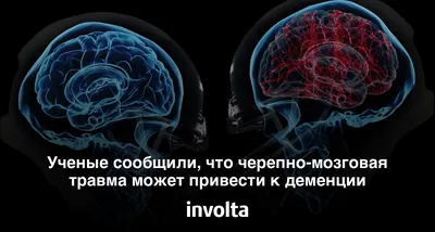 Черепно-мозговая травма и ремонт Иллюстрация штока - иллюстрации  насчитывающей неврология, медицинско: 30997155