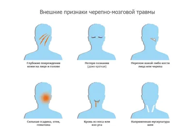 Черепно-мозговые травмы - Кортексин