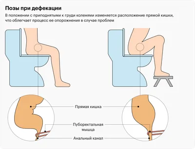 КАК ПЕРЕСТАТЬ ДОЛГО СИДЕТЬ В ТУАЛЕТЕ? - YouTube