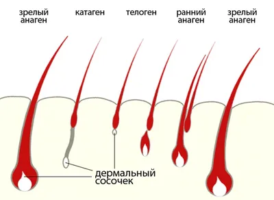 Электроэпиляция - удаление волос навсегда - Sokratoclinica.lt магазин