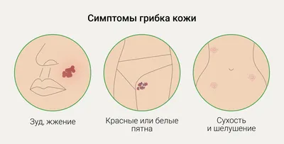 Дерматология. Иллюстрированное руководство ГЭОТАР-Медиа 26202741 купить за  3 431 ₽ в интернет-магазине Wildberries