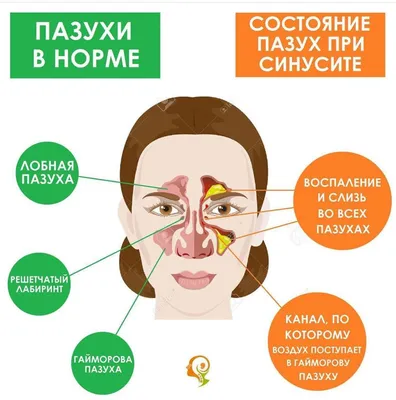 Диагностика пазух носа при помощи УЗИ » ЛОР клиника «ЛОР-Практика» в  Алматы: лечение заболеваний уха, горла, носа у детей и взрослых