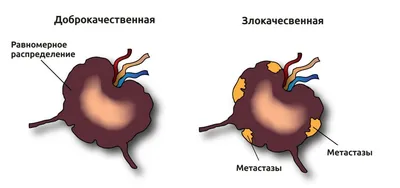 Лимфатическая система человека: что это, функции, строение, состав, свойства