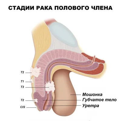 Ваши летние отёки зависят от лимфатической системы. Помогаем ей работать  как часы и они уходят (это не сложно) | Пампушка на сушке | Дзен