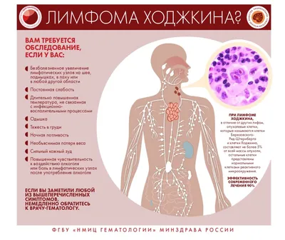 Почему воспаляются лимфоузлы? | Блог о здоровье