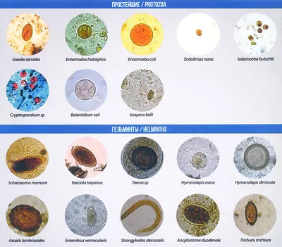 Анализ на гельминты: цена в Москве