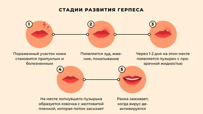 Аллергия на лице у взрослых и детей: что делать и чем лечить сыпь на коже