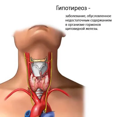 Врожденный гипотиреоз у детей. Причины, диагностика и лечение