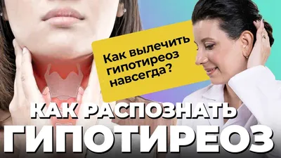 ГИПОТИРЕОЗ: СОВРЕМЕННОЕ СОСТОЯНИЕ ПРОБЛЕМЫ – тема научной статьи по  клинической медицине читайте бесплатно текст научно-исследовательской  работы в электронной библиотеке КиберЛенинка