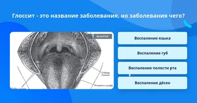 Складчатый глоссит: причины, симптомы, лечение и гигиена рта