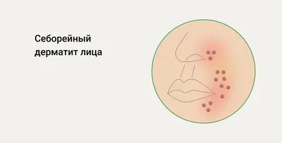 Я просыпалась ночами - настолько чесалось лицо»: учитель биологии подцепила  грибок после чистки лица - KP.RU