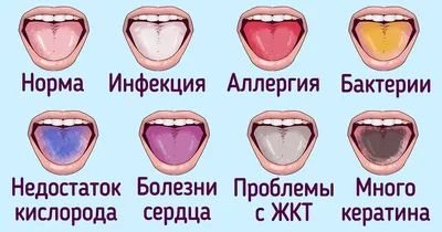 Чистка языка от налета в домашних условиях - Как правильно чистить язык при  чистке зубов