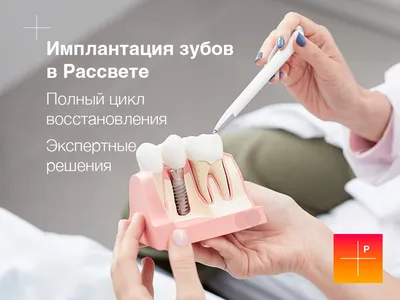 Имплантация верхней челюсти: цена в Москве на протезирование передних и  жевательных зубов при их полном отсутствии