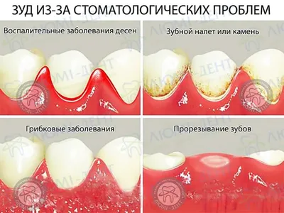 Перхоть и чешется голова: как избавиться от перхоти и зуда головы?