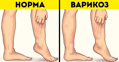 Чешется небо: почему так происходит и что сделать