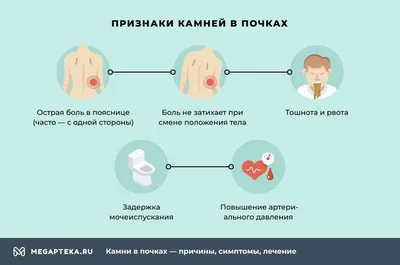 Врачи больницы имени С.И. Спасокукоцкого спасли почку мужчины, удалив из  нее 7 сантиметровый камень | Пикабу