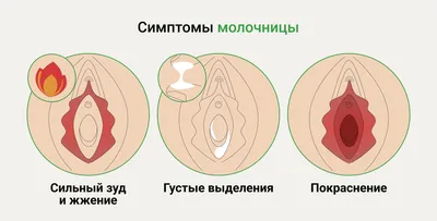 Грибок кожи: симптомы и разновидности — Медицинская лаборатория IMD