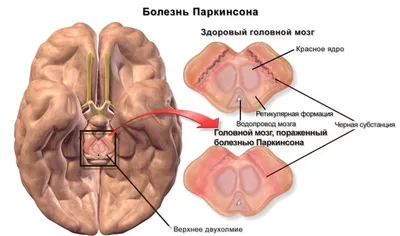 Что происходит в Кремле? - YouTube