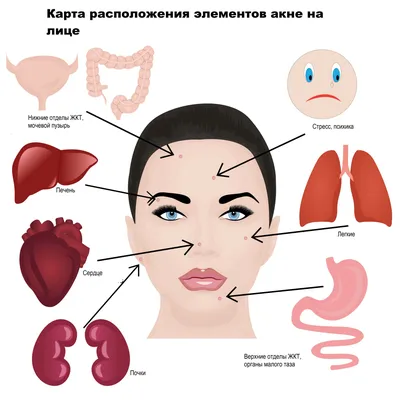 Renastere - Центр аппаратной косметологии - За какие органы отвечают прыщи  на лице, и как выявить заболевание по зоне высыпаний?🤔 Сохрани себе на  стену чтоб не потерять😉 Лицо и внутренние органы –