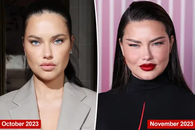 Former Victoria's Secret model Adriana Lima responds to plastic surgery  accusations | Fox News