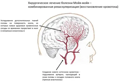 Болезни, которые обостряются зимой